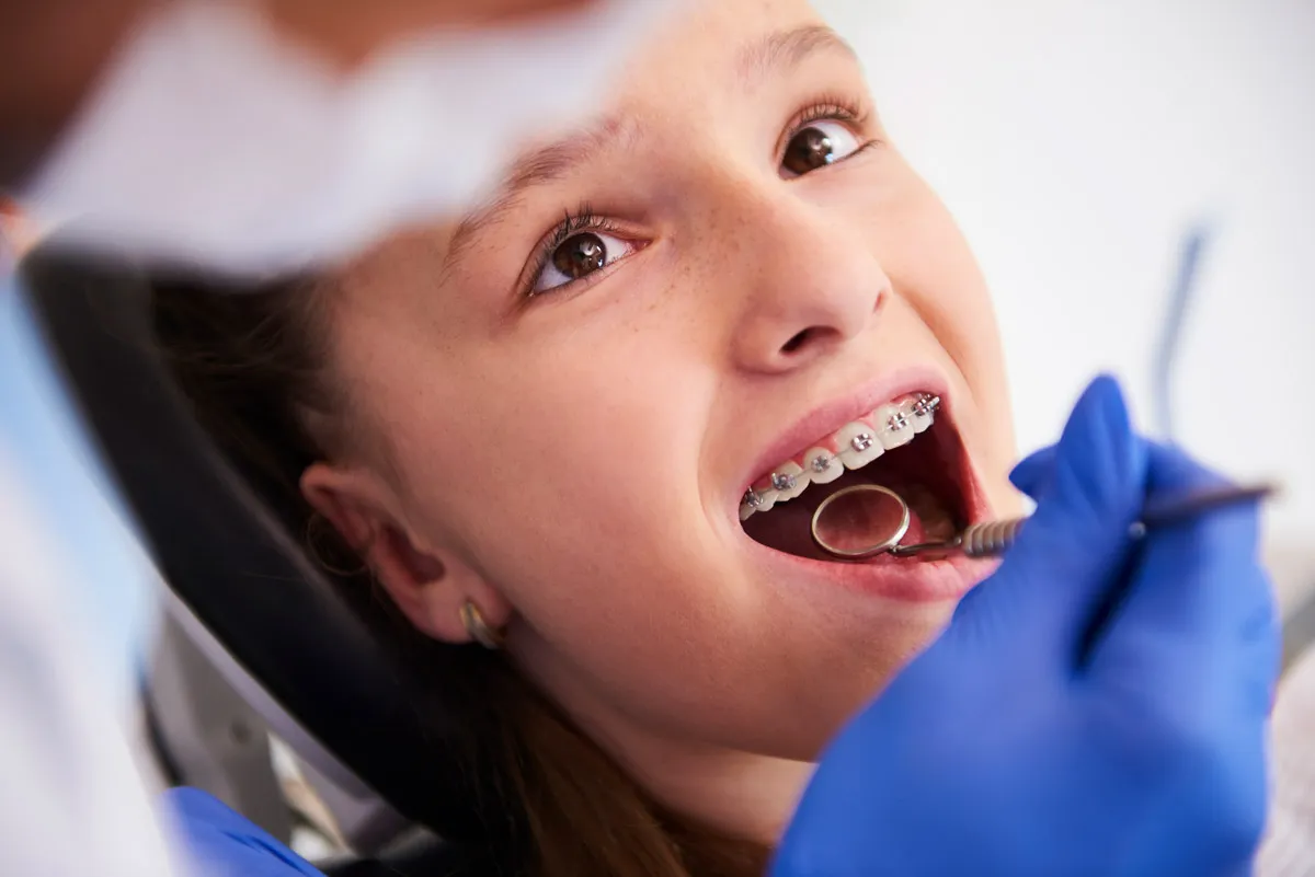 Apparecchio dentale per bambini