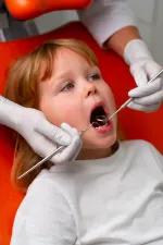 Otturazioni denti da latte a Firenze