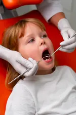 Otturazioni denti da latte a Firenze